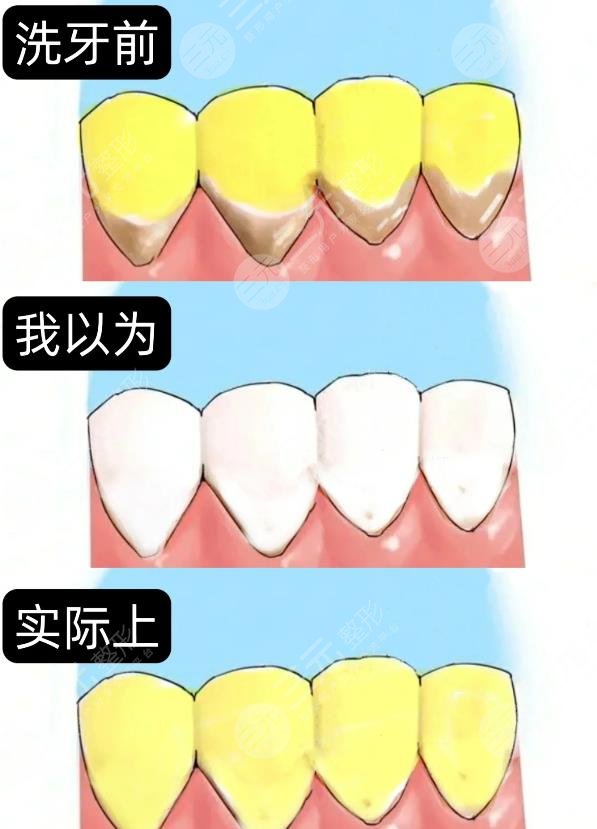 牙齒發(fā)黃變白的方法有哪些