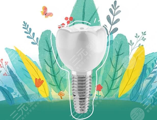 種植牙好嗎?