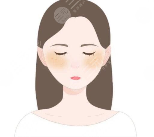 去除黃褐斑價(jià)格大概是多少？哪種方式祛斑見效快！