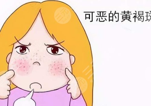 激光祛斑會不會反彈？
