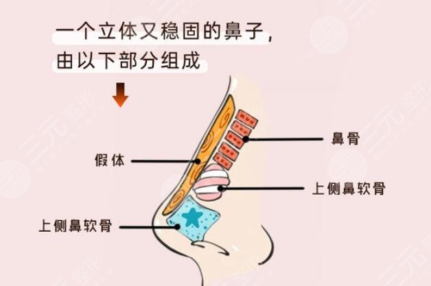 假體隆鼻怎樣去進(jìn)行護(hù)理?
