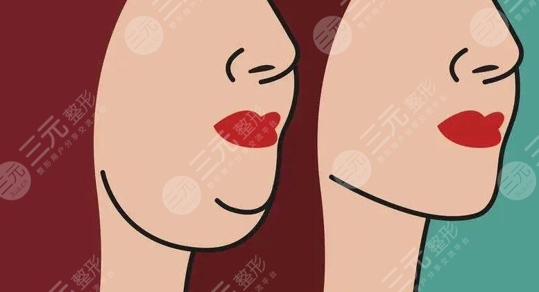 甩掉雙下巴的方法