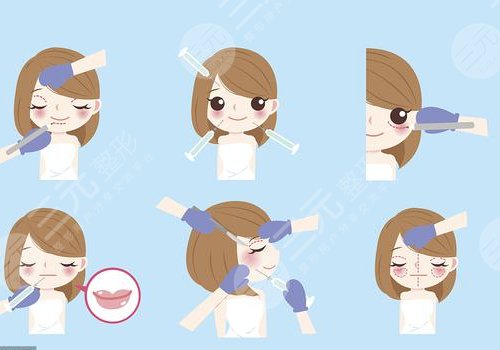 微調(diào)整形有風(fēng)險嗎？
