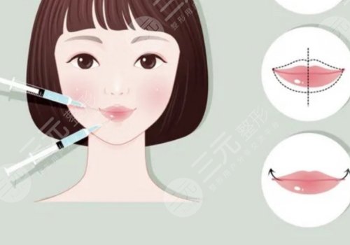 微調(diào)整形有風(fēng)險嗎？