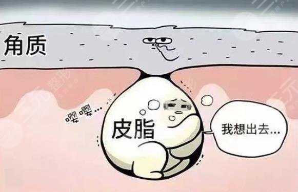 閉合性粉刺怎么調(diào)理