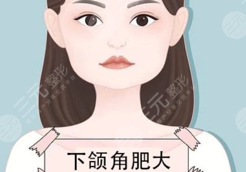 輪廓整形有哪些方法?