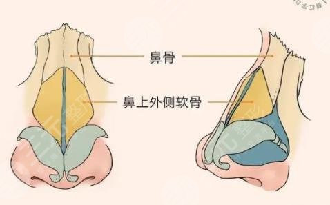 鼻修復(fù)