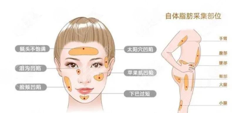 清華大學玉泉醫(yī)院美容整形中心擅長項目