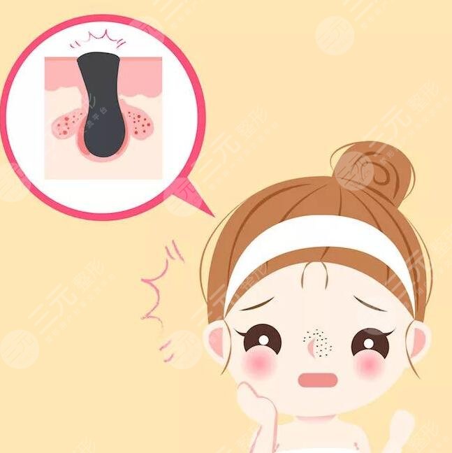 去黑頭貼