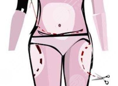 吸脂瘦腰