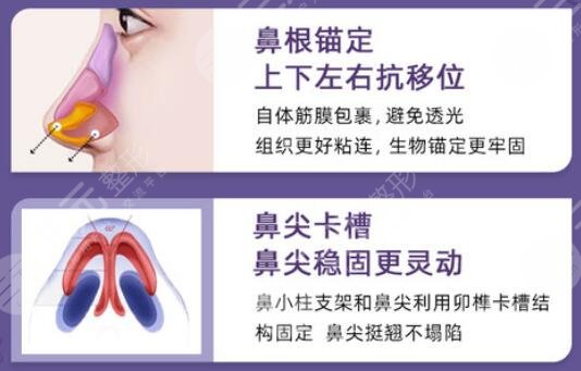 隆鼻