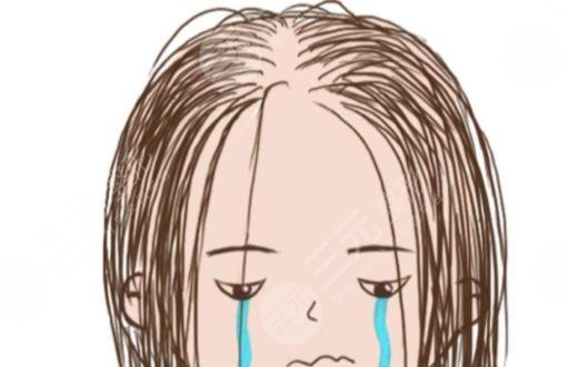發(fā)際線