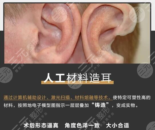 耳再造