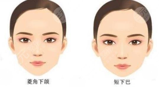 磨骨h