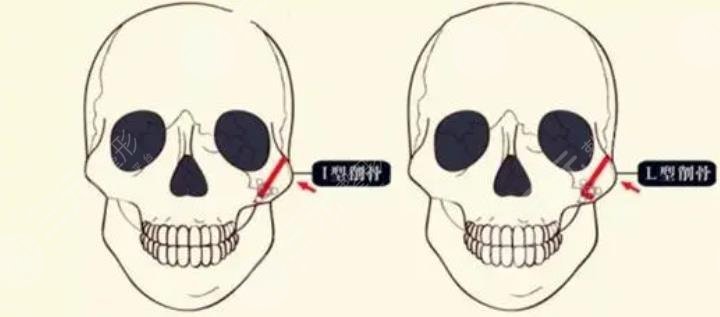 磨骨h