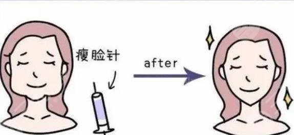 瘦臉針