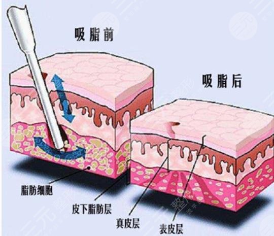 嘟嘟肉