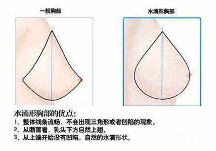 劉林奇