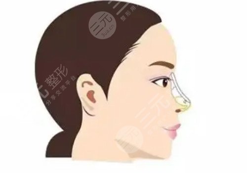 葉麗萍做鼻子怎么樣？