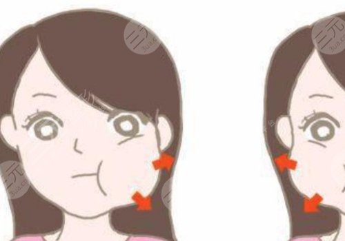 咬肌太大怎么辦如何讓咬肌變??？