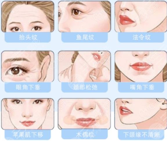 雙矢量提升術多大歲數(shù)能做