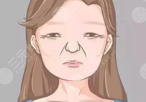 括號紋怎么去掉？怎么形成的？改良方式解讀！