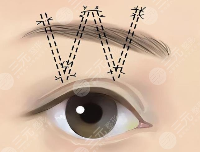 切眉