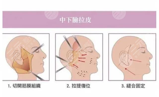 蕭志波醫(yī)生擅長項目