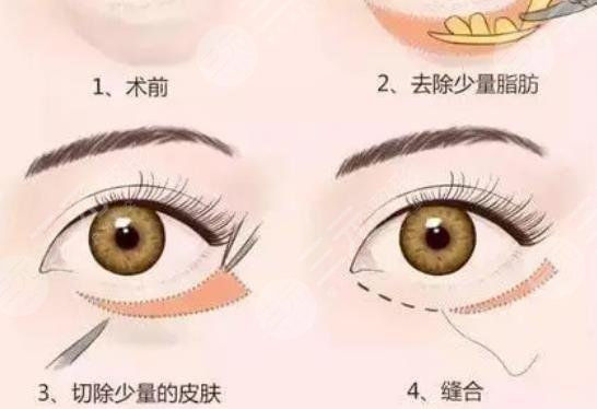蕭志波醫(yī)生擅長項目