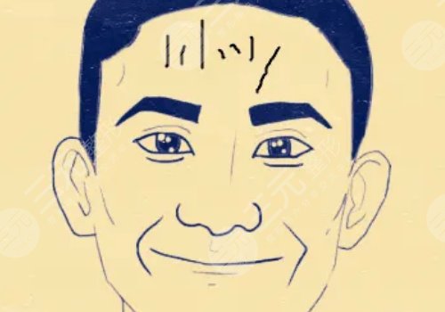 抬頭紋怎么去除有效男生？