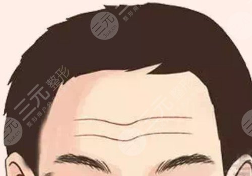 抬頭紋怎么去除有效男生？