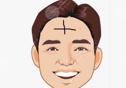 抬頭紋怎么去除有效男生？