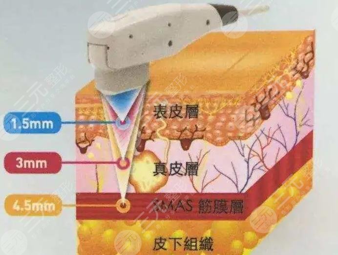 超聲