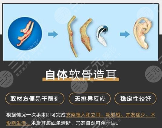 耳朵整形