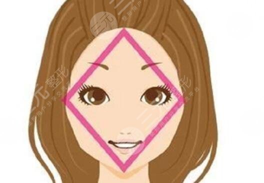 輪廓固定