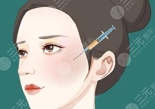 內輪廓固定