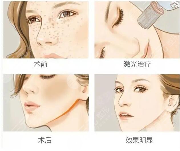 北京空軍總醫(yī)院美容激光中心相關(guān)技術(shù)介紹