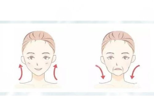 皺紋去除的好辦法是什么？