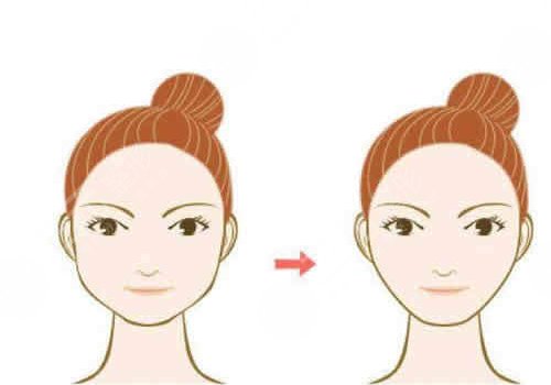 做完輪廓手術(shù)臉更大了怎么回事？