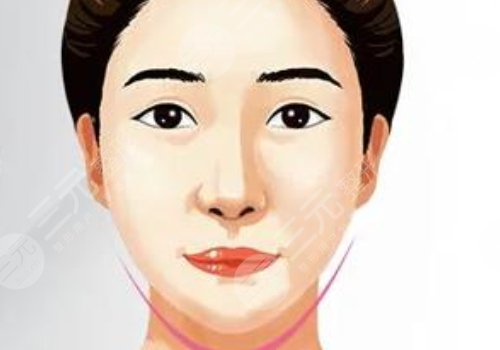 內(nèi)外輪廓固定做手術(shù)要多久？
