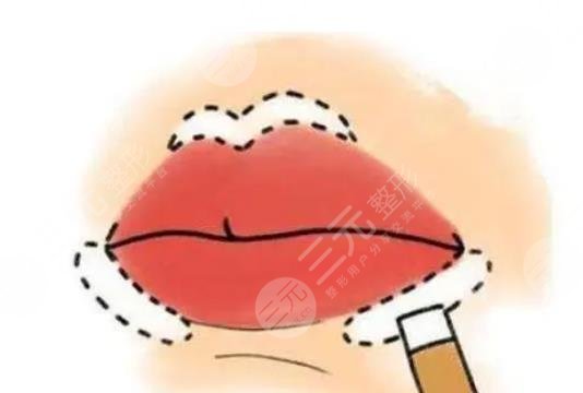 厚唇修薄