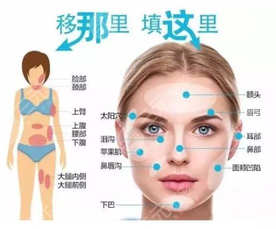 幼態(tài)臉整形是怎么做的？