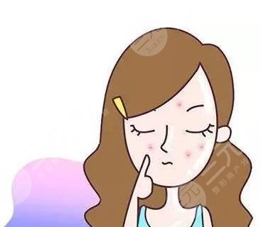 祛痘