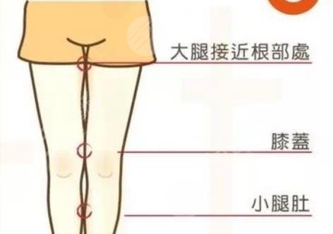 大腿抽脂