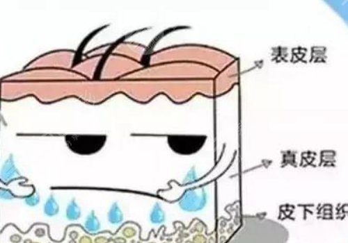 玻尿酸豐胸優(yōu)缺點(diǎn)