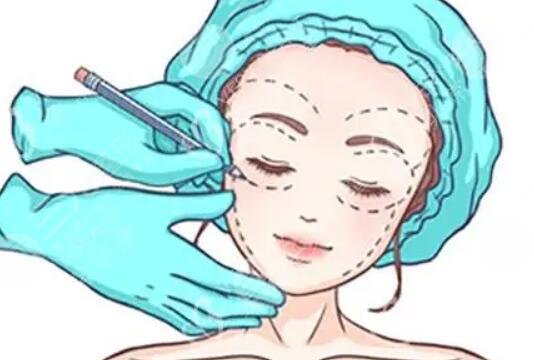 輪廓針
