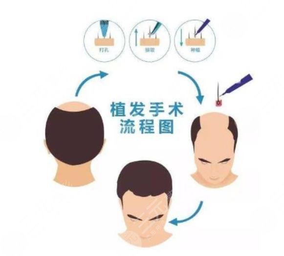 北京大學(xué)第三醫(yī)院整形科擅長項目