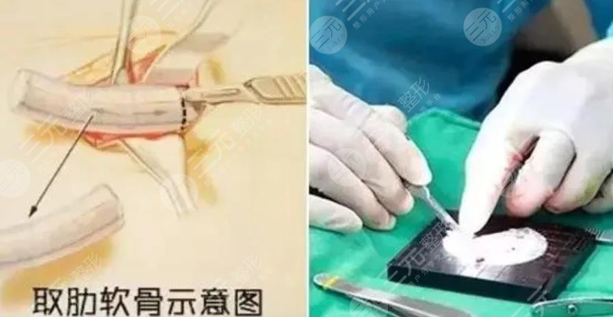 上海仁濟(jì)醫(yī)院整形美容外科擅長(zhǎng)項(xiàng)目科普