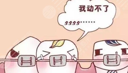 牙齒矯正