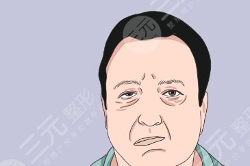 面癱后遺癥